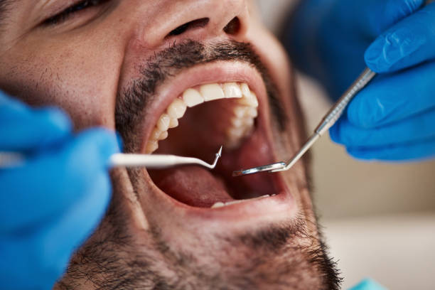 Best Emergency Treatment for Oral Infections in Franklinton, LA